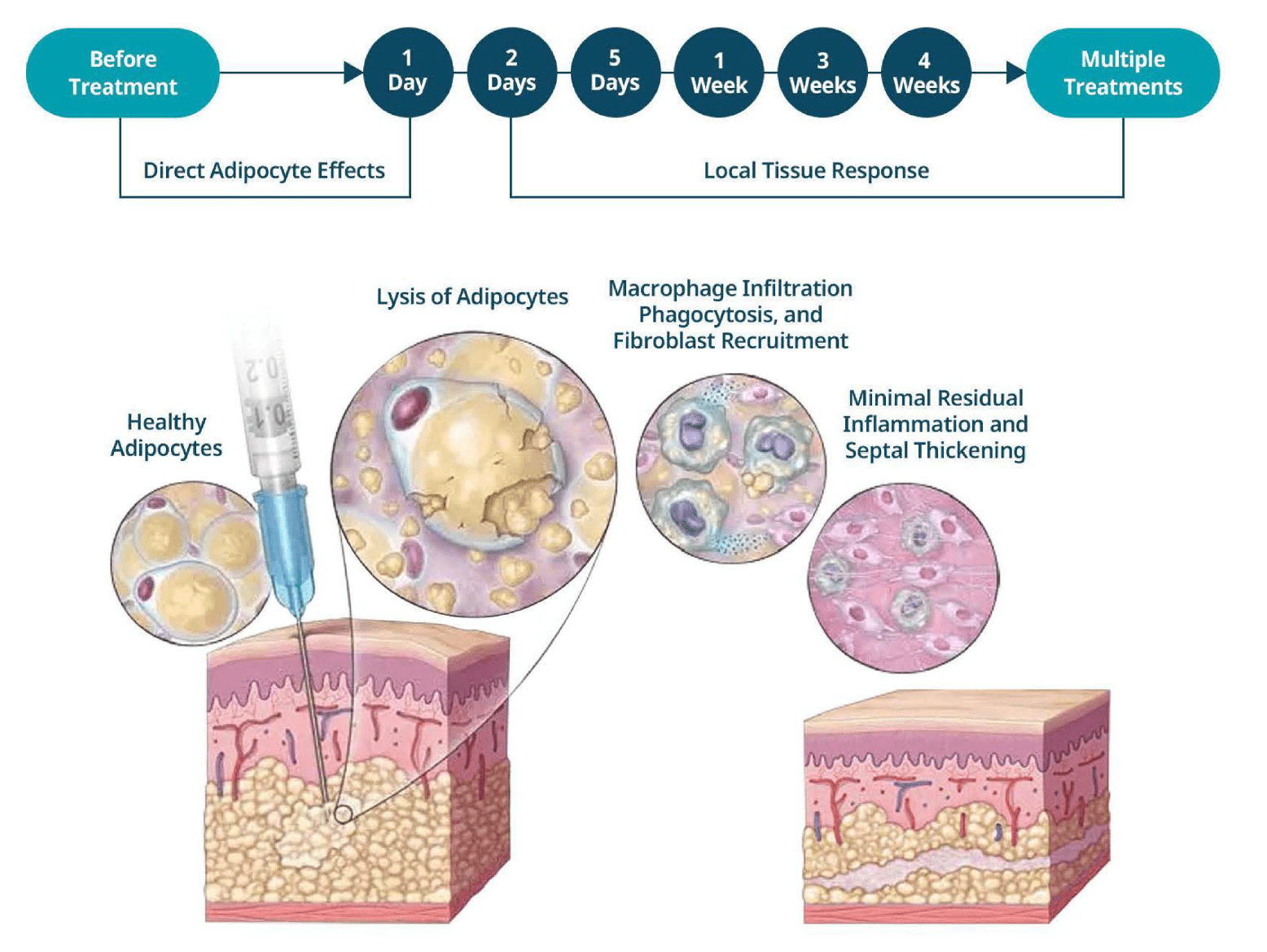 Dr-lipo-mechanism